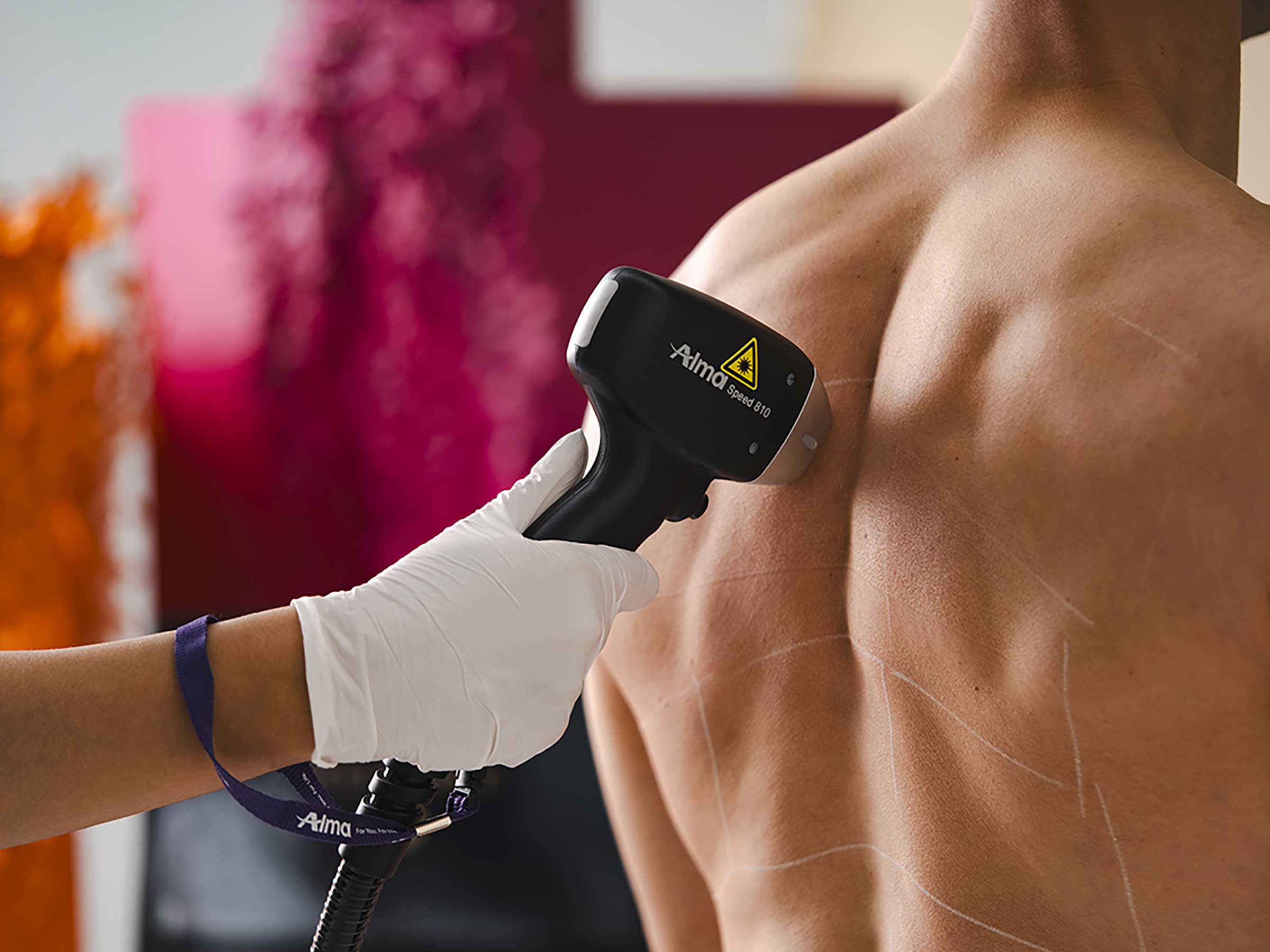 Épilation laser dos